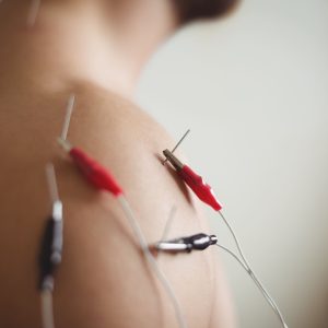 Curso Básico de Neuromodulación Percutánea
