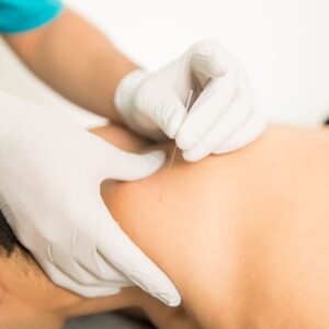 Abordaje Clínico del Síndrome de Dolor Miofascial
